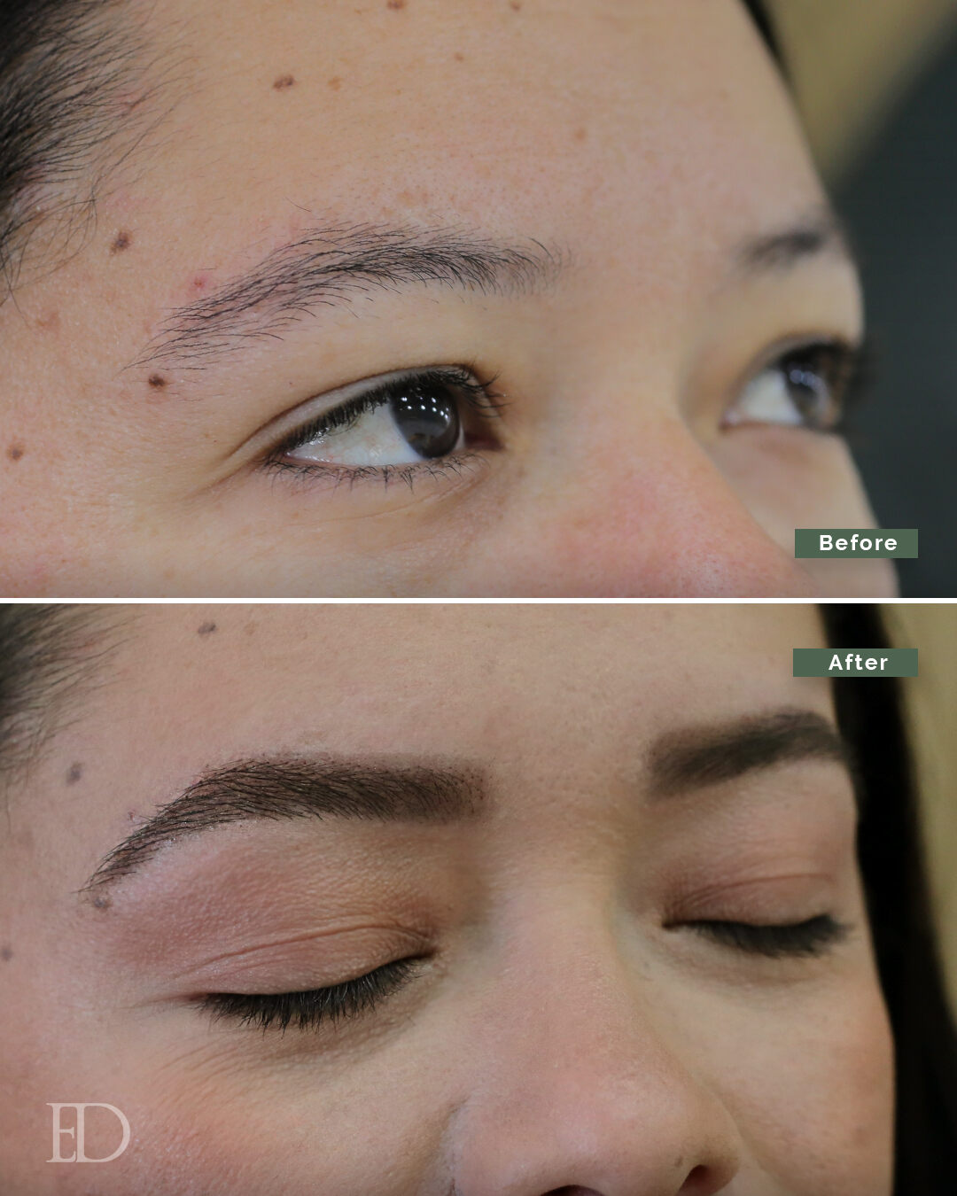 Growth Bundle: 4 Booster Treatments + 1 Growth Serum