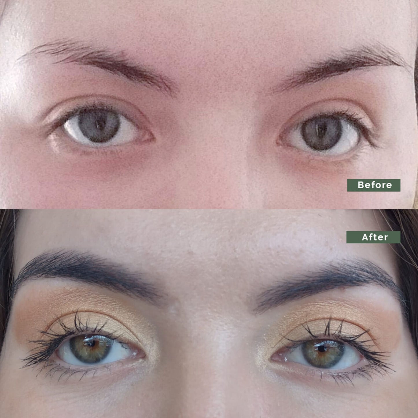 Growth Bundle: 4 Booster Treatments + 1 Growth Serum