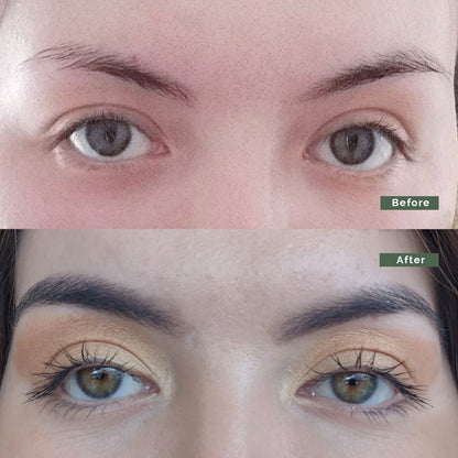 Growth Bundle: 4 Booster Treatments + 1 Growth Serum