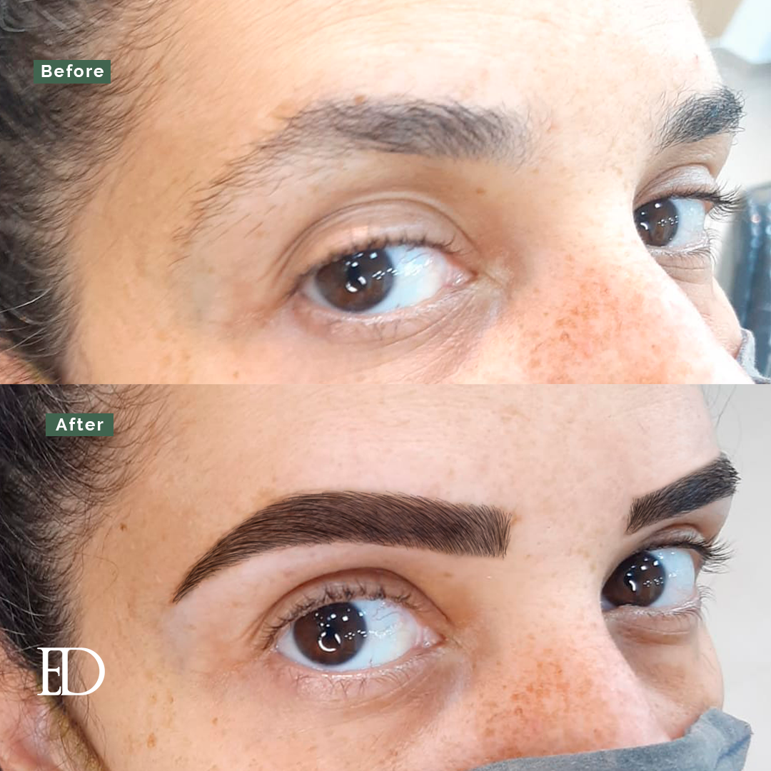 Growth Bundle: 4 Booster Treatments + 1 Growth Serum