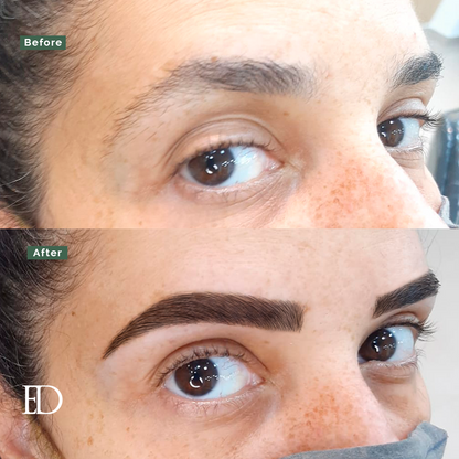 Growth Bundle: 4 Booster Treatments + 1 Growth Serum